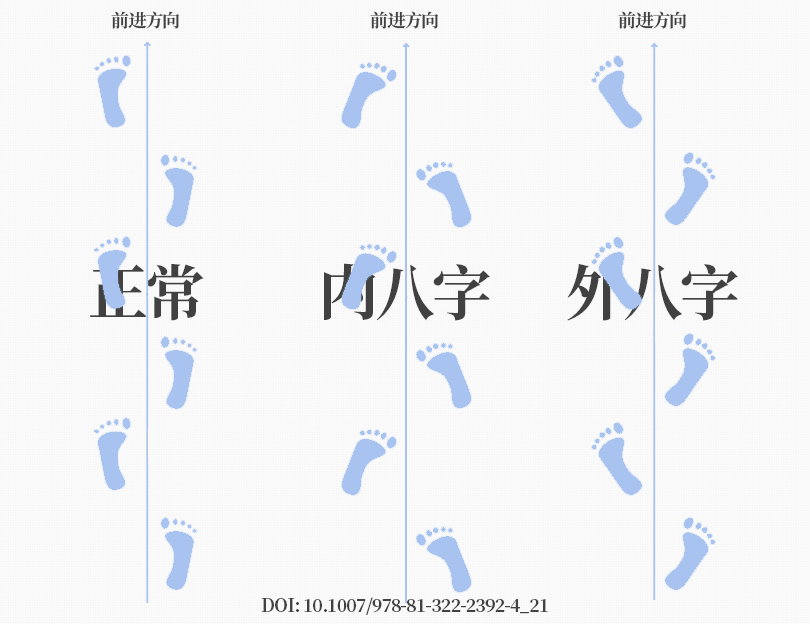 SPI足底壓力分布計量